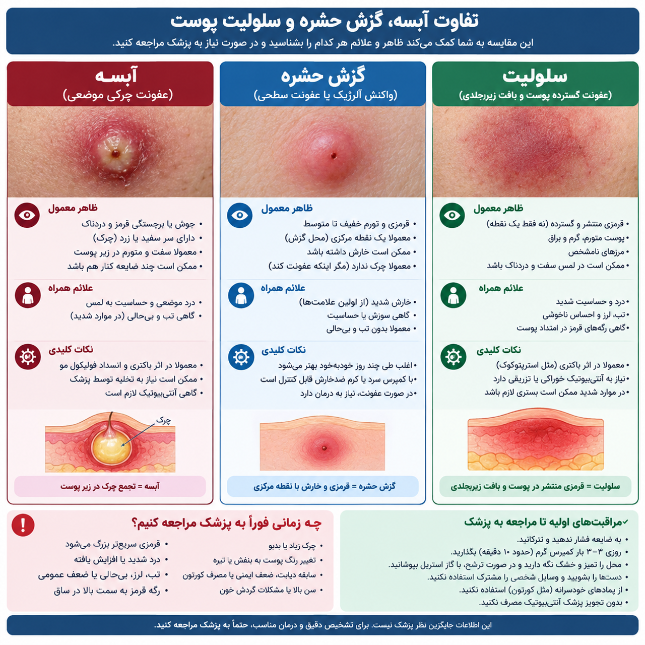 آبسه، گزش حشره یا سلولیت؟